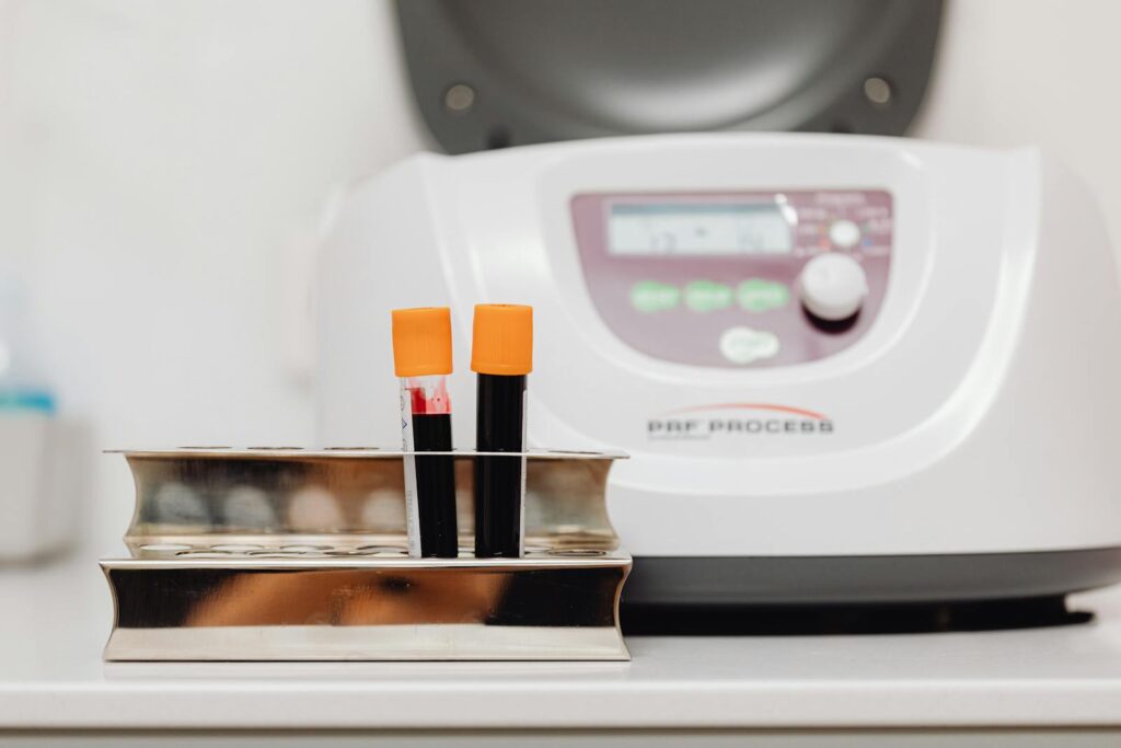 Blood samples in a rack with centrifuge in a laboratory environment.